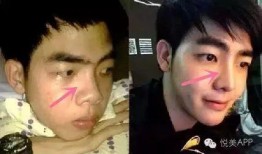 整容男网红吃瓜事件图片,揭秘网络红人背后的真相